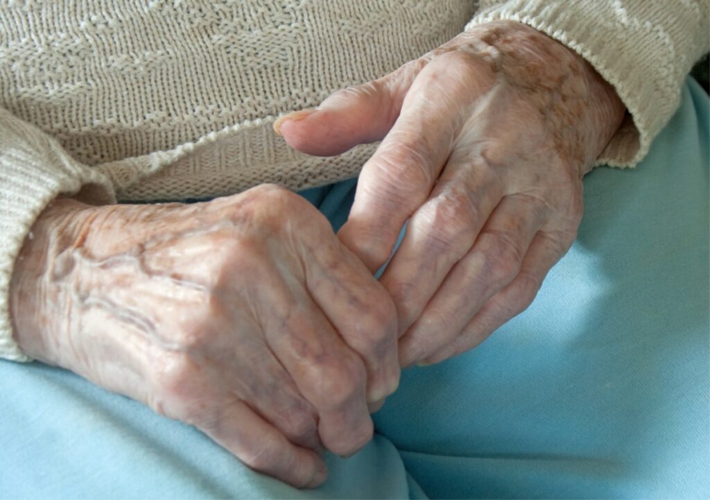 Elder Care in Los Gatos AZ: Arthritis